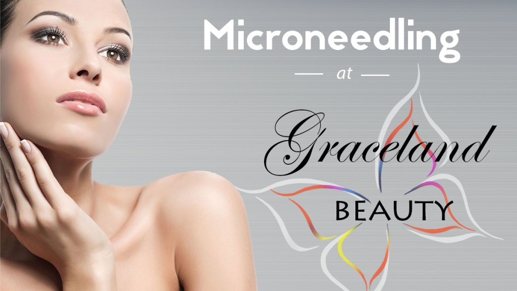 Microneedling-treatments-Graceland Beauty